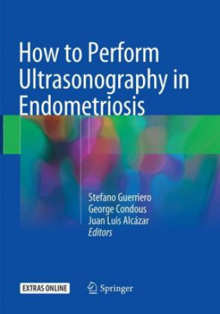 Kniha How to Perform Ultrasonography in Endometriosis Stefano Guerriero