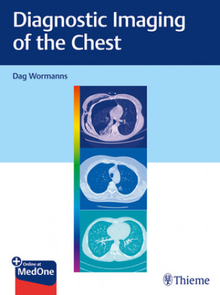 Kniha Diagnostic Imaging of the Chest Dag Wormanns