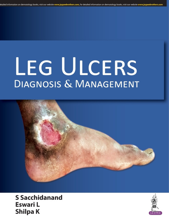 Βιβλίο Leg Ulcers S Sacchidanand