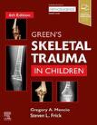 Könyv Green's Skeletal Trauma in Children GREGORY MENCIO
