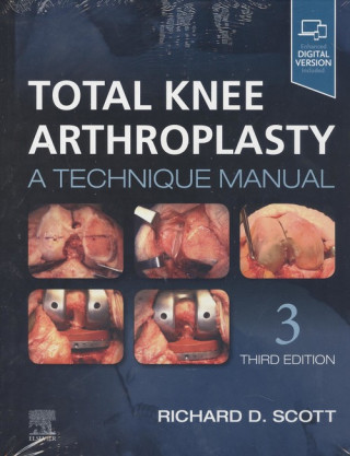 Kniha Total Knee Arthroplasty 