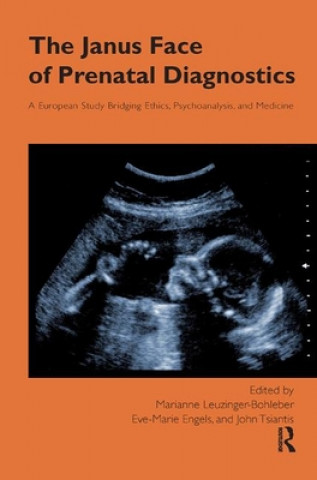 Knjiga Janus Face of Prenatal Diagnostics 