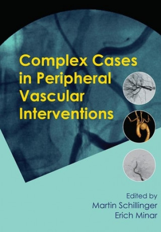 Boek Complex Cases in Peripheral Vascular Interventions Martin Schillinger