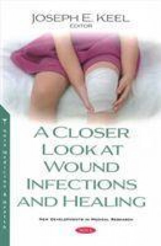Carte Closer Look at Wound Infections and Healing 