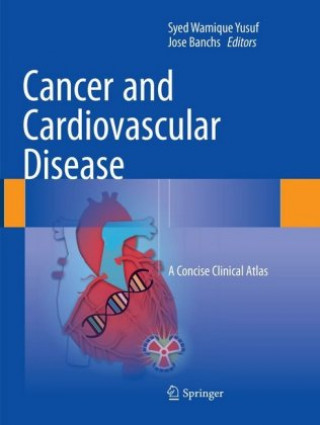 Livre Cancer and Cardiovascular Disease Syed Wamique Yusuf