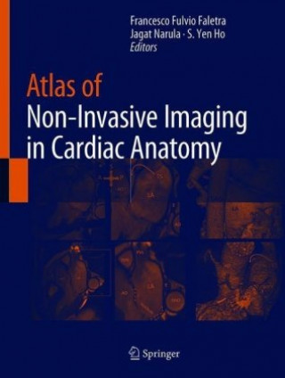 Knjiga Atlas of Non-Invasive Imaging in Cardiac Anatomy Francesco Fulvio Faletra