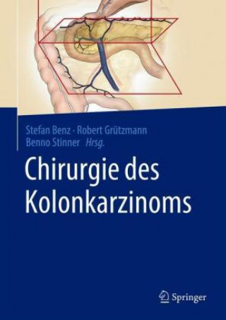 Carte Chirurgie des Kolonkarzinoms Robert Grützmann