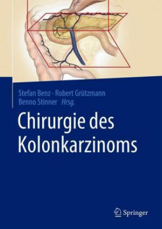 Βιβλίο Chirurgie des Kolonkarzinoms Robert Grützmann