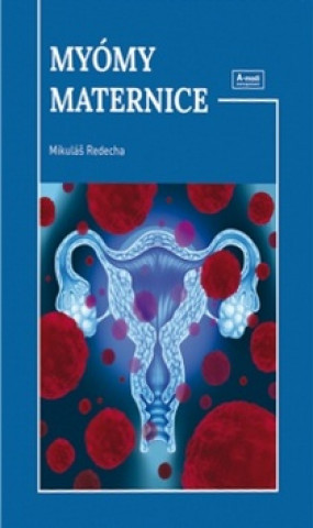 Könyv Myómy maternice Mikuláš Redecha