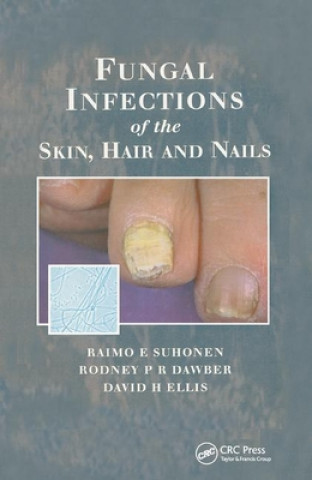 Kniha Fungal Infections of the Skin and Nails Raimo E. Suhonen