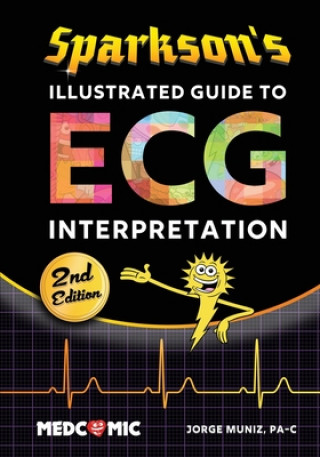 Książka Sparkson's Illustrated Guide to ECG Interpretation, 2nd Edition 