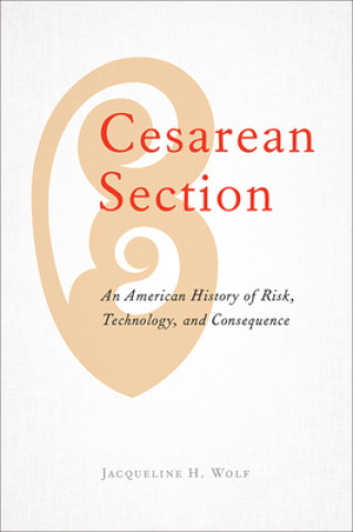 Kniha Cesarean Section Jacqueline H. Wolf