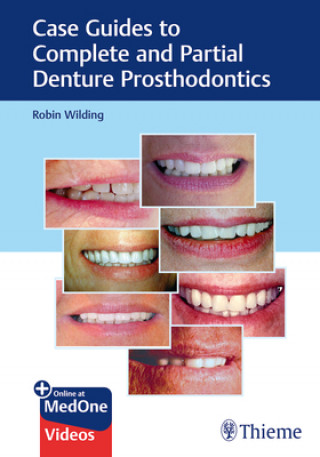 Knjiga Case Guides to Complete and Partial Denture Prosthodontics Robin Wilding