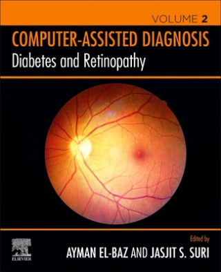 Книга Diabetes and Retinopathy Jasjit S. Suri