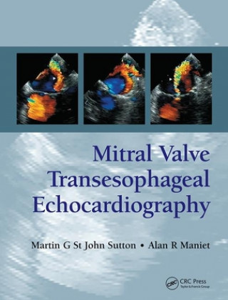 Kniha Mitral Valve Transesophageal Echocardiography Martin G. St. John Sutton