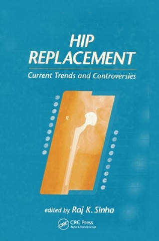 Книга Hip Replacement Raj K. Sinha