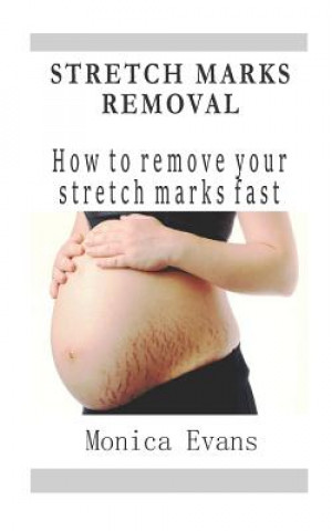 Kniha Stretch Marks Removal: How to remove your stretch marks fast Monica Evans