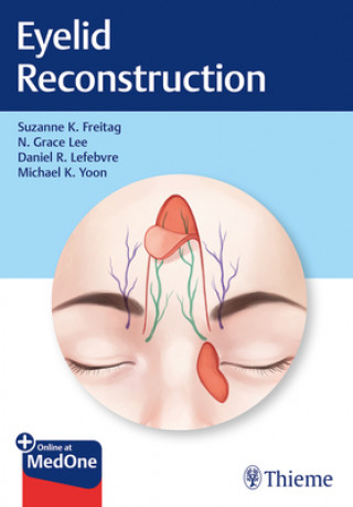 Kniha Eyelid Reconstruction Nahyoung Grace Lee