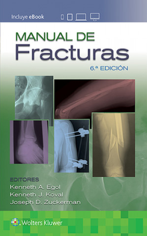 Kniha Manual de fracturas Kenneth Egol