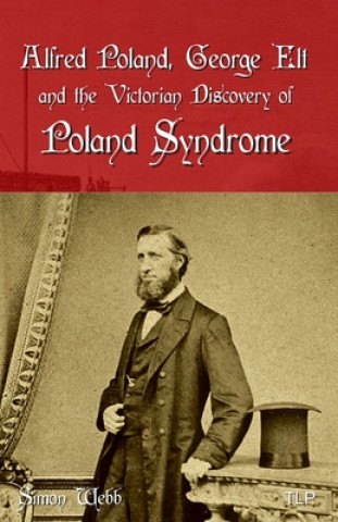 Kniha Alfred Poland, George Elt and the Victorian Discovery of Poland Syndrome Simon Webb