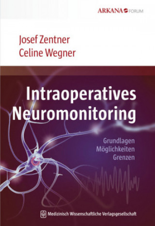 Kniha Intraoperatives Neuromonitoring Celine Wegner