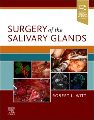 Kniha Surgery of the Salivary Glands 