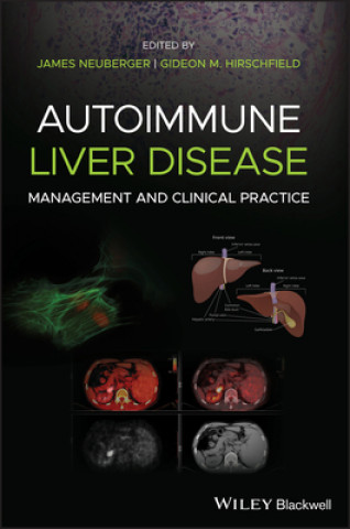 Книга Autoimmune Liver Disease - Management and Clinical  Practice 