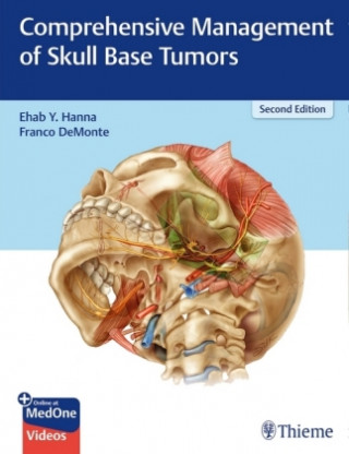 Kniha Comprehensive Management of Skull Base Tumors Franco Demonte