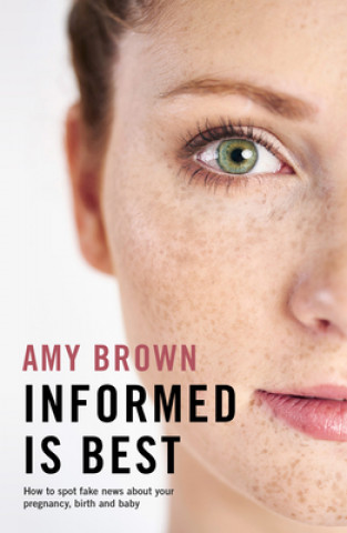 Kniha Informed is Best Amy Brown