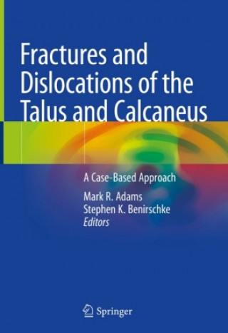 Book Fractures and Dislocations of the Talus and Calcaneus Mark Adams