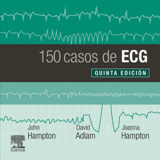 Könyv 150 CASOS DE ECG JOHN HAMPTON