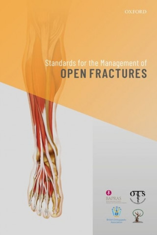 Carte Standards for the Management of Open Fractures 