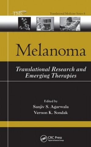 Knjiga Melanoma Sanjiv S. Agarwala