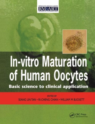 Kniha In Vitro Maturation of Human Oocytes 