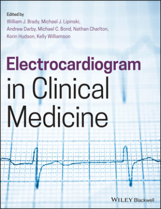 Carte Electrocardiogram in Clinical Medicine 