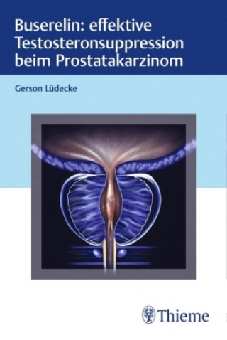 Книга Buserelin: effektive Testosteronsuppression beim Prostatakarzinom 