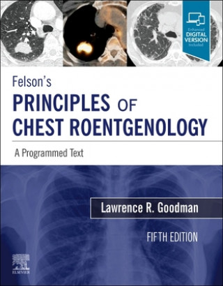 Kniha Felson's Principles of Chest Roentgenology, A Programmed Text Lawrence R Goodman