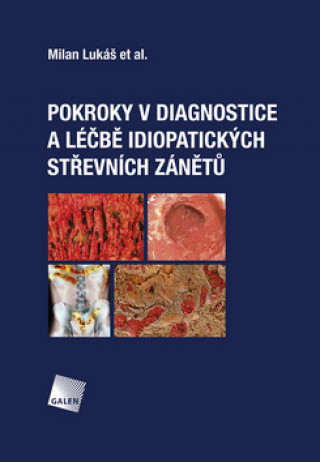 Könyv Pokroky v diagnostice a léčbě idiopatických střevních zánětů Milan Lukáš