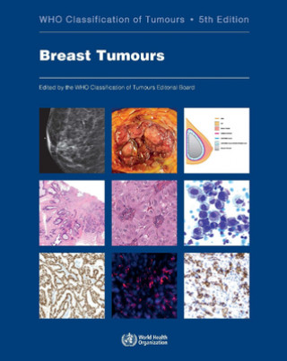 Kniha Breast Tumours: Who Classification of Tumours 