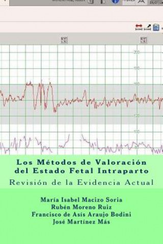 Carte Los Métodos de Valoración del Estado Fetal Intraparto: Revisión de la Evidencia Actual Ruben Moreno Ruiz