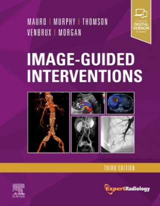 Knjiga Image-Guided Interventions Mauro