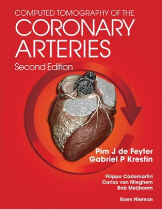 Книга Computed Tomography of the Coronary Arteries 