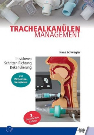 Könyv Trachealkanülenmanagement Hans Schwegler