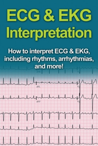 Книга ECG & EKG Interpretation 