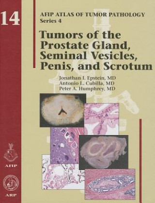 Kniha Tumors of the Prostate Gland, Seminal Vesicles, Penis, and Scrotum Robert H. Young