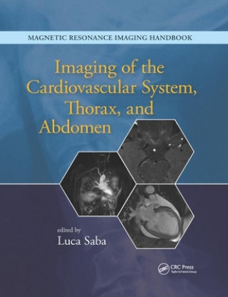 Książka Imaging of the Cardiovascular System, Thorax, and Abdomen 