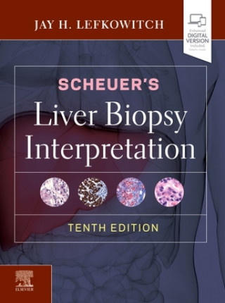 Kniha Scheuer's Liver Biopsy Interpretation 