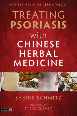 Carte Treating Psoriasis with Chinese Herbal Medicine (Revised Edition) Ma Lili