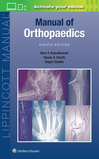 Könyv Manual of Orthopaedics 