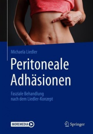 Carte Peritoneale Adhäsionen Michaela Liedler